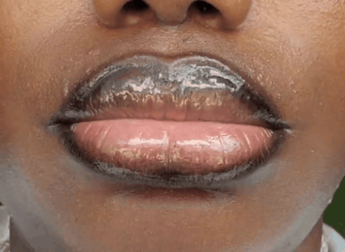 Person's Mouth Close Up With Hole