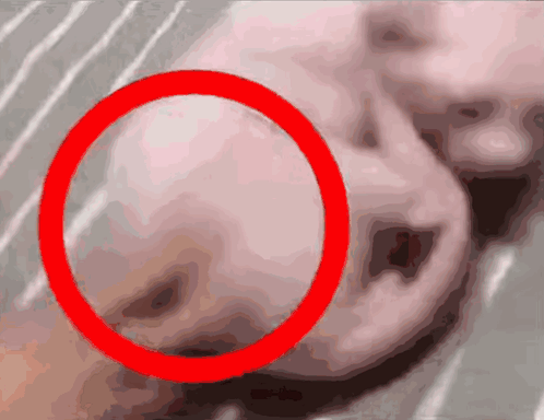 Person With Red Circle Around Nose