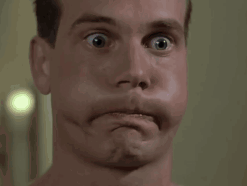 Person With Surprised Look
