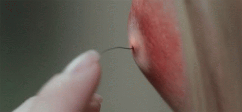 Scary Tiny Tentacle Pimple Popping GIF