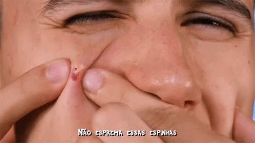 Pimple Popping Head Peeking Out Meme GIF