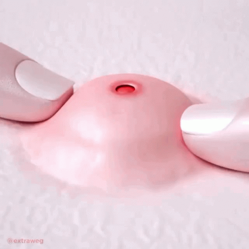 Fake Pimple Head Popping Out GIF