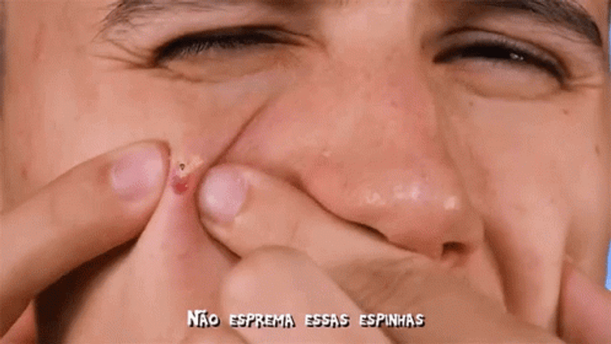 Pimple Popping Head Peeking Out Meme GIF