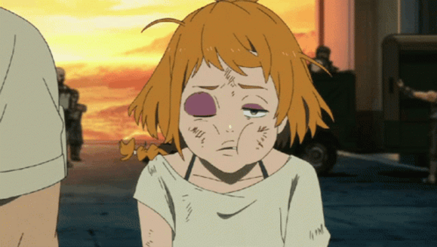 Pitiful Anime Deca-Dence Beat Up Face GIF