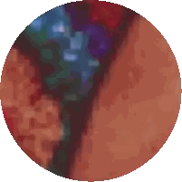 Pixelated Person Face With Red Blue Circle