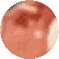 Pixelated Red Circle