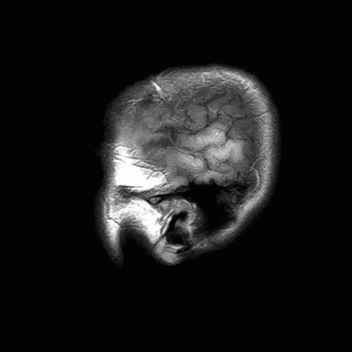 Radiology Xray Scanners GIF