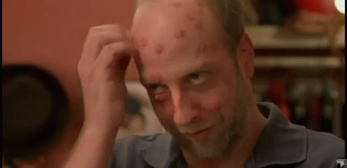 Scab Guy Itchy Head GIF