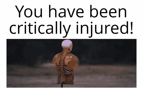 Skeleton Saying You Have Been Critically Injured GIF