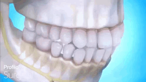 Skull With Braces Saying Surgical