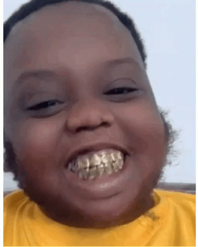 Smiling Baby Has Gold Teeth GIF