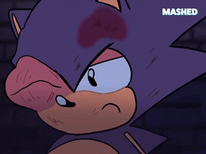 Sonic The Hedgehog Swollen Black Eye GIF