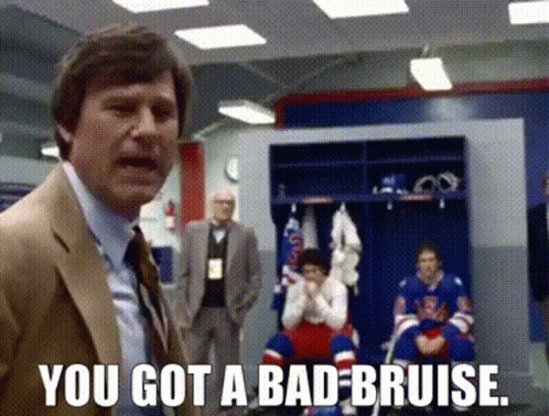 Suit Man Saying You Got Bad Bruise Hockey