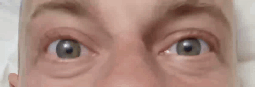Surprised Person's Eyes