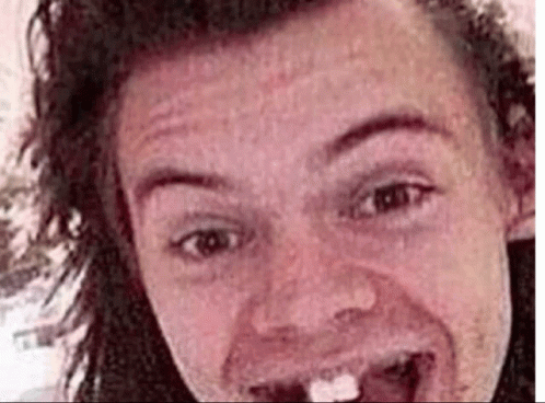 Ugly Harry Styles Predebut Pics GIF