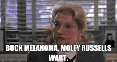 Uncle Buck Melanoma Moley Russells Wart GIF