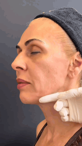 Woman Eyes Closed Examined by Gloved Hand
