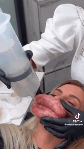 Woman Getting Botox Treatment