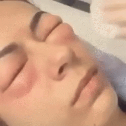 Woman Getting Facial Treatment With Syringe GIF