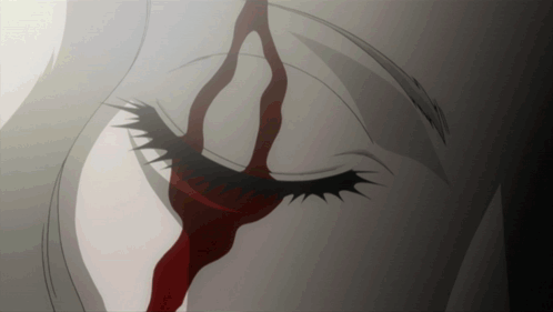 Woman's Eye Bleeding
