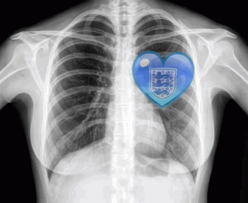 X-Ray Chest Blue Heart England Crest