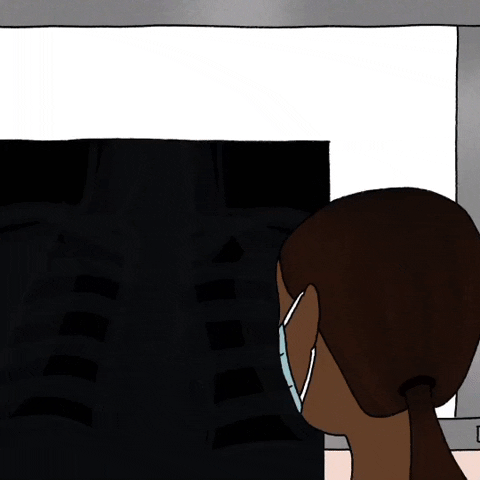 X-ray Film Scan Lungs GIF