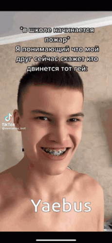 Young Man With Braces And Yaebus On Phone GIF