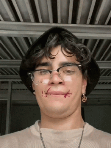 Young Man with Glasses and Stitches