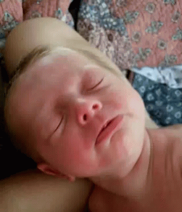 A Baby Is Sleeping On A Bed With His Eyes Closed And His Face Is Covered In Red Spots . GIF