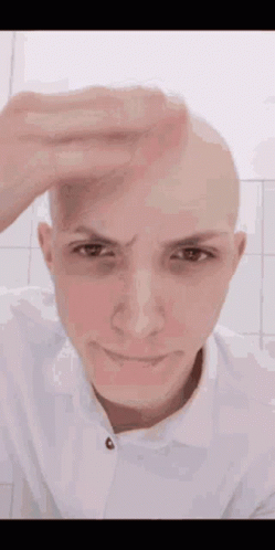 A Bald Man Is Holding His Hand To His Forehead And Smiling . GIF