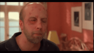 A Bald Man With A Beard And A Black Eye GIF