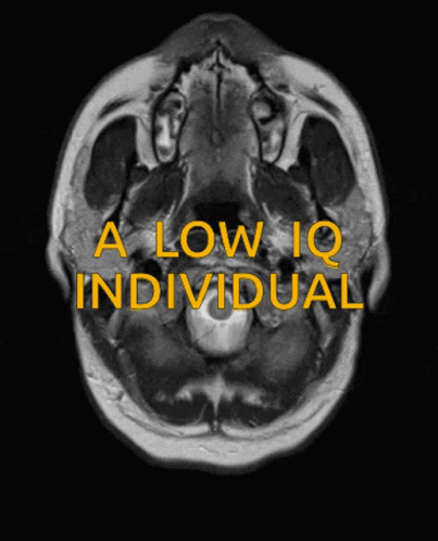 A Black And White Image Of A Brain With The Words A Low Iq Individual In Yellow GIF