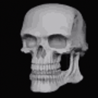 A Black And White Photo Of A Human Skull Without Teeth . GIF