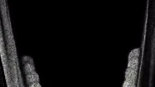 A Black And White Photo Of A Person Screaming With Their Mouth Open . GIF
