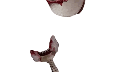 A Bloody Skull With A Skeleton Behind It Sticker