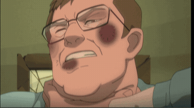 a cartoon of a man with glasses and a black eye