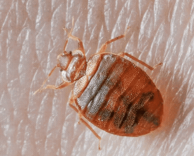 A Close Up Of A Bed Bug On A Persons Skin GIF