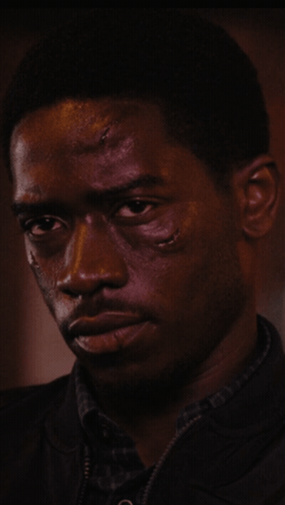A Close Up Of A Man 'S Face With A Few Spots On It GIF