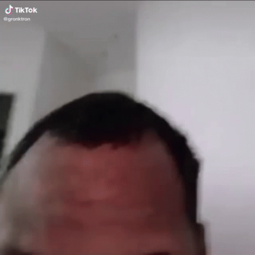 A Close Up Of A Man 'S Head With A Very Long Haircut . GIF