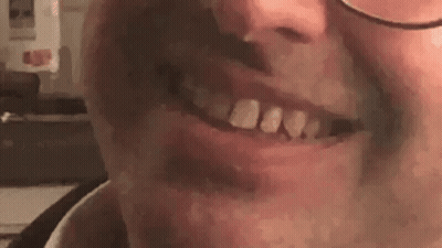 A Close Up Of A Man 'S Mouth With Glasses And A Missing Tooth . GIF