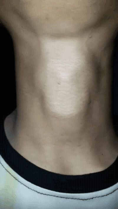 A Close Up Of A Man 'S Neck With A Black Collar GIF