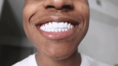 A Close Up Of A Man 'S Teeth With A White Shirt On GIF