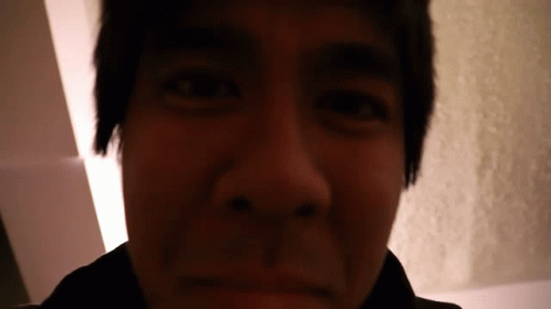 A Close Up Of A Person 'S Face With A Black Eye GIF