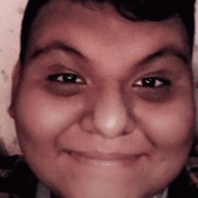 A Close Up Of A Person 'S Face With A Black Eye GIF