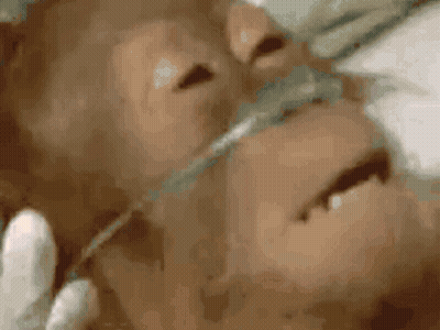 A Close Up Of A Person 'S Face With An Oxygen Mask GIF