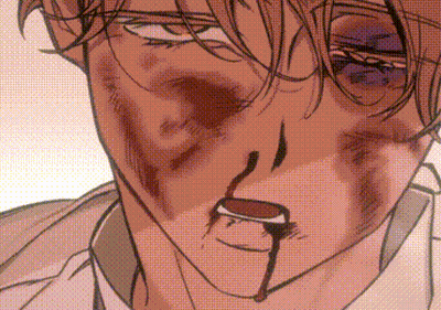 A Close Up Of A Person 'S Face With Blood Coming Out Of It . GIF