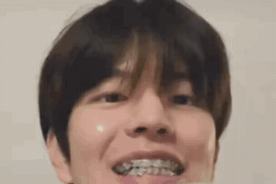 A Close Up Of A Person 'S Face With Braces On His Teeth . GIF