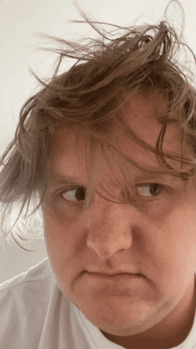 A Close Up Of A Person 'S Face With Messy Hair GIF