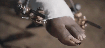 A Close Up Of A Person 'S Foot With A Bandage On It . GIF