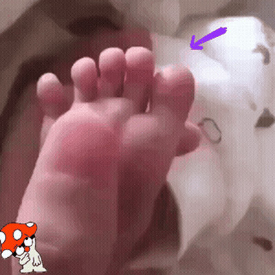 A Close Up Of A Person 'S Foot With A Mushroom And Arrow Pointing To The Toe . GIF